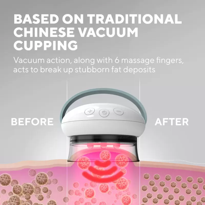 Máy massage trị liệu da làm tan mỡ công nghệ nóng lạnh HoMedics CELL-600-EU 6 Kết quả rõ rệt chỉ sau 28 ngày sử dụng