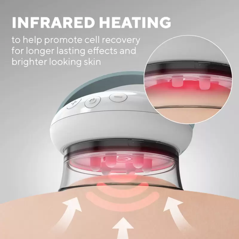 Máy massage trị liệu da làm tan mỡ công nghệ nóng lạnh HoMedics CELL-600-EU 5 Smoothee sử dụng công nghệ hút chân không để hút da vào cốc đồng thời massage mô sâu.